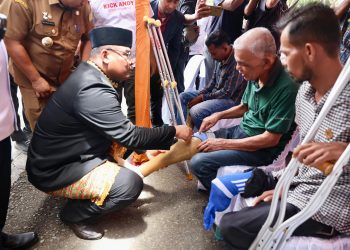 49 Warga Aceh Terima Bantuan Kaki Palsu